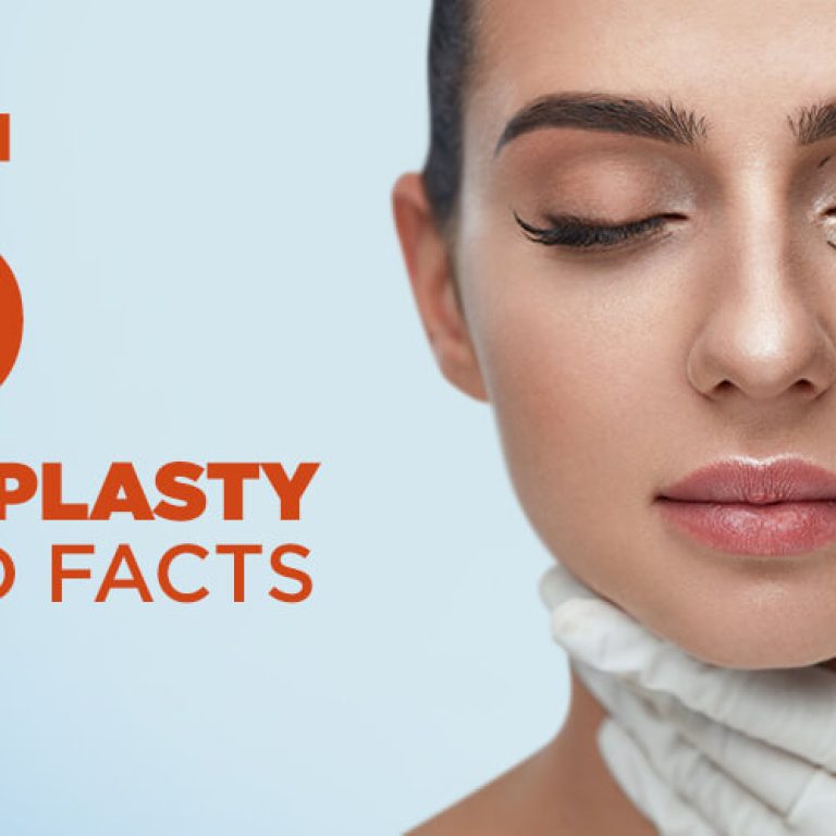 5-blepharoplasty-myths-and-facts