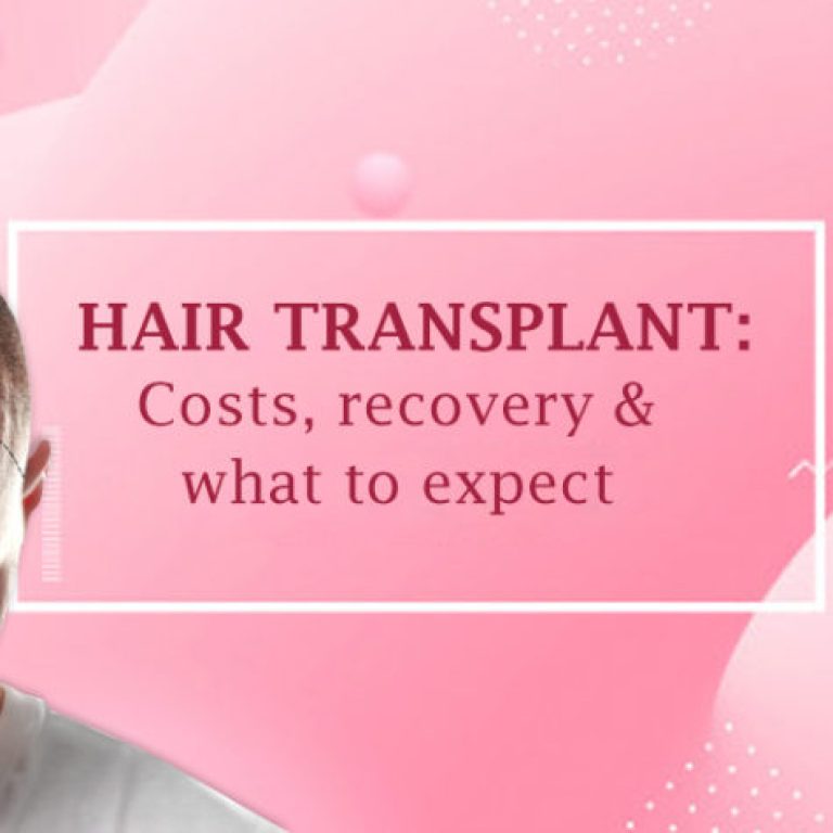 hair-transplant-explained
